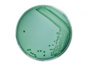 Những điều chưa biết về nhóm vi khuẩn Vibrio